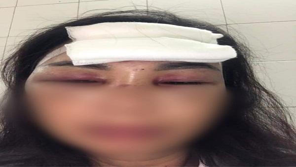 Vợ tố chồng chích điện, dìm xuống ao