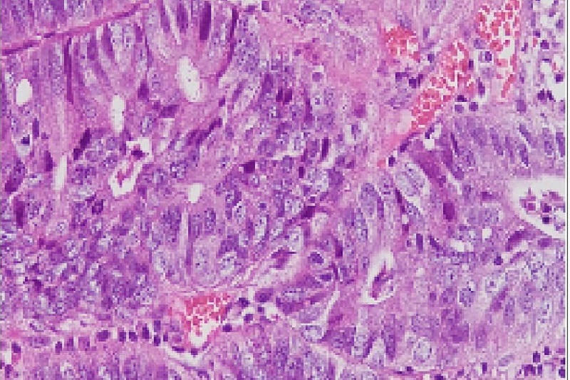 Êm ái, nhẹ nhàng, an tâm giữ 'vàng' ngay trong giấc ngủ