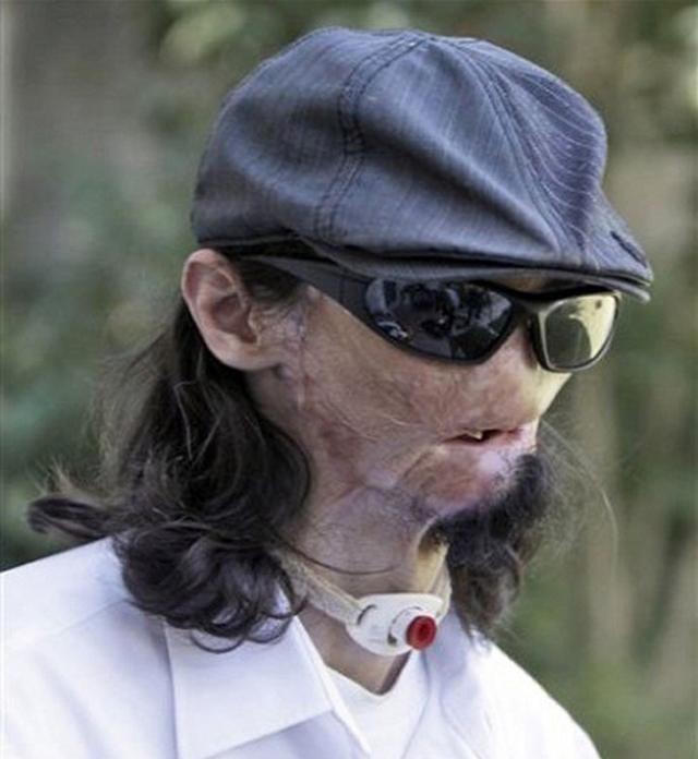 Hạnh phúc viên mãn của người đàn ông “không mặt”