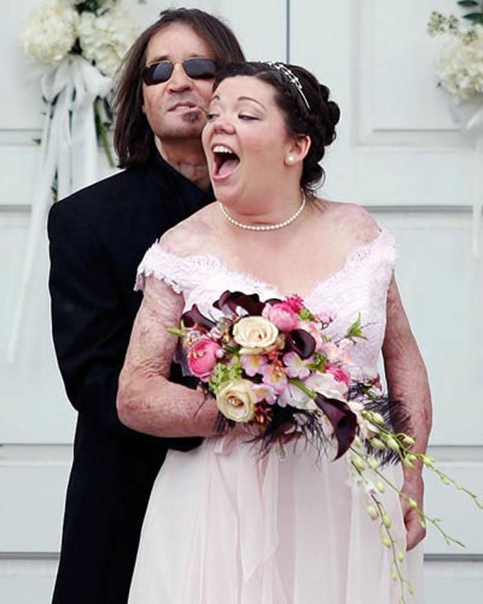 Hạnh phúc viên mãn của người đàn ông “không mặt”