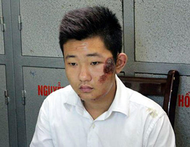 Lật lại lời khai của bác sĩ ném xác nạn nhân thẩm mỹ