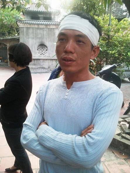 Lộ diện nghi phạm thứ 3 trong vụ thẩm mỹ viện ném xác