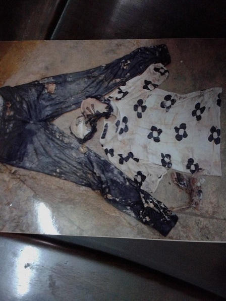 Bí ẩn hộp sọ nghi của chị Lê Thị Thanh Huyền