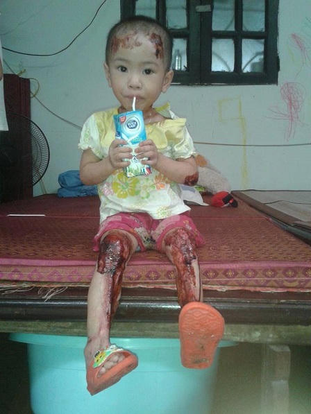 Cộng đồng mạng dậy sóng kêu gọi “cứu bé Tâm Anh ở Bồ Đề“