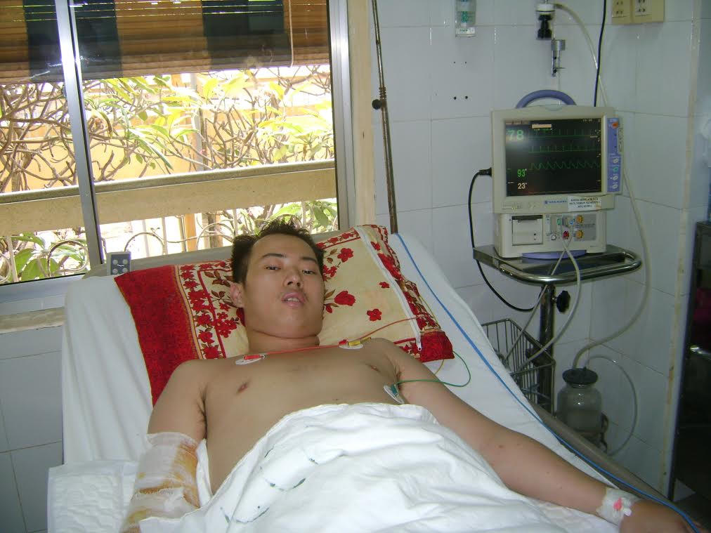 Sóc Trăng: Cứu sống bệnh nhân bị sốt xuất huyết thể hiếm gặp 