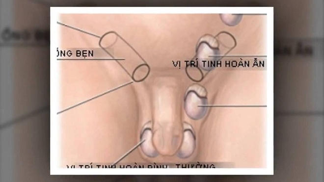 Cha mẹ cần quan tâm tới "chuyện khó nói" của con 