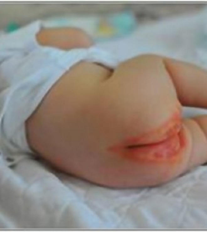 Mất giống nòi vì…lạm dụng bỉm