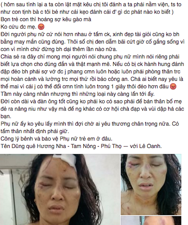 Xả giận vào 'của quý' của chồng, cô giáo tiểu học bị đánh rúng động dư luận?