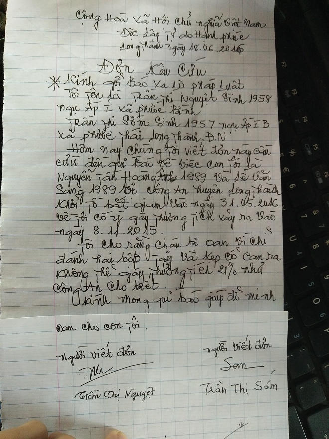 2 bạt tai, tổn thương… 21% sức khỏe?