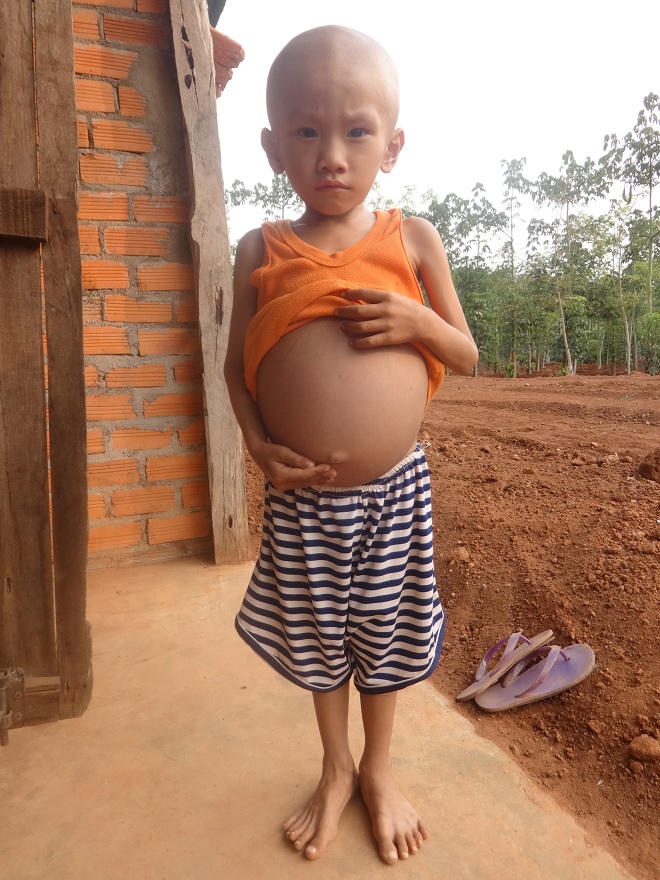 Chuyện cảm động về người cha một mình nuôi con mắc bạo bệnh