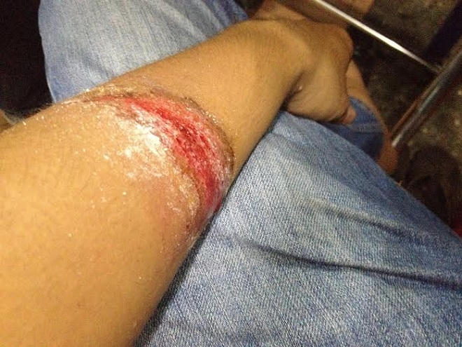 Thót tim nghe thành viên Đội săn bắt cướp TP HCM kể chuyện 