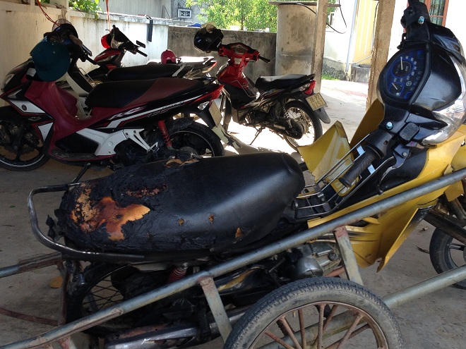 Sức chịu đựng phi thường của người đàn bà bị chồng đổ xăng đốt