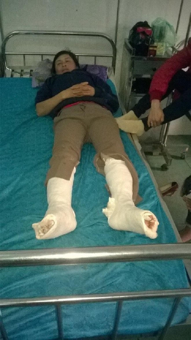 Đánh đập người mẹ, cắt gân chân con vì khoản nợ 25 triệu   