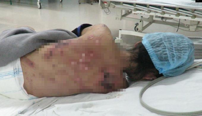 Nhóm tra tấn nhân viên như thời trung cổ lĩnh án 54 năm tù