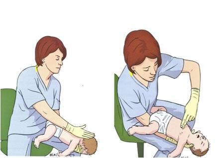 Sau vụ bé gái Bình Thuận tử vong do hóc hạt nhãn, chuyên gia khuyến cáo cách sơ cứu