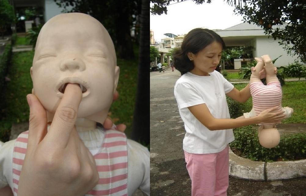 Sau vụ bé gái Bình Thuận tử vong do hóc hạt nhãn, chuyên gia khuyến cáo cách sơ cứu