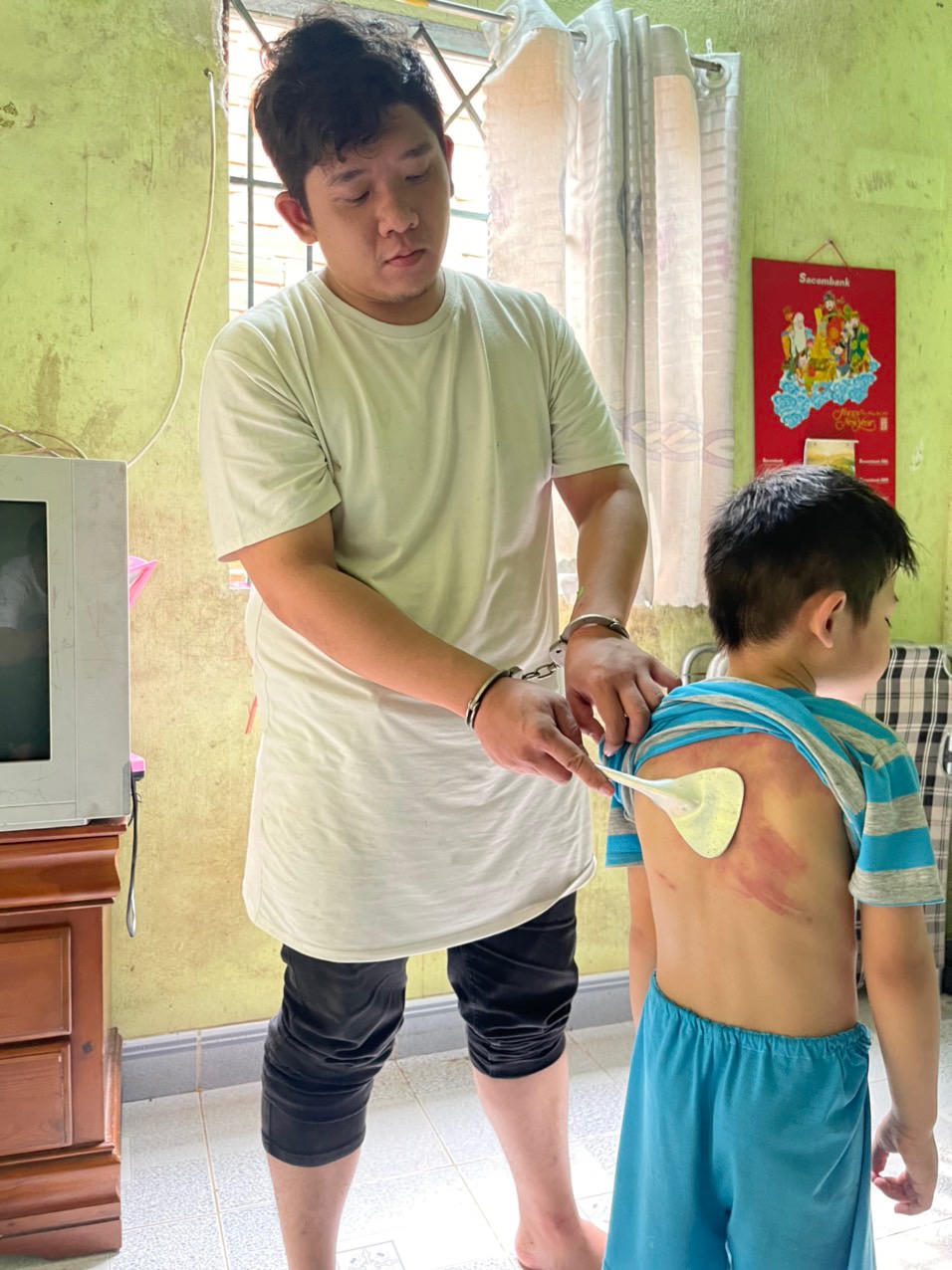 Tạm giữ người cha liên tục bạo hành con trai 5 tuổi
