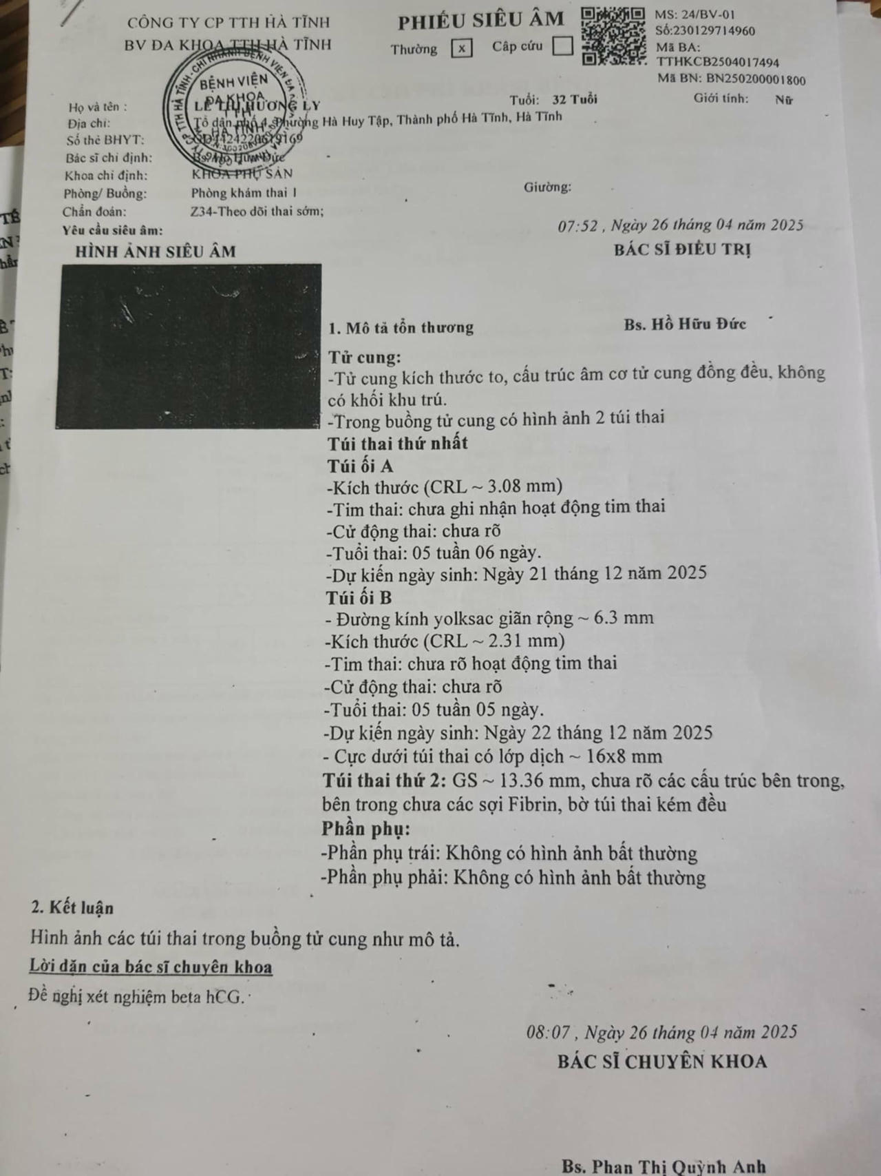 Kết quả siêu âm thai ngày 26/4/2025 của chị Ly. (Ảnh trong bài: T.Lan)