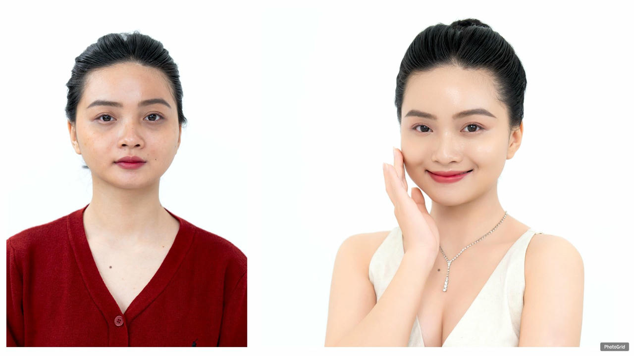  Sự thay đổi rõ rệt của chị Lan trước và sau khi trị liệu tại Viện thẩm mỹ DIVA với làn da sáng mịn, căng bóng rõ rệt