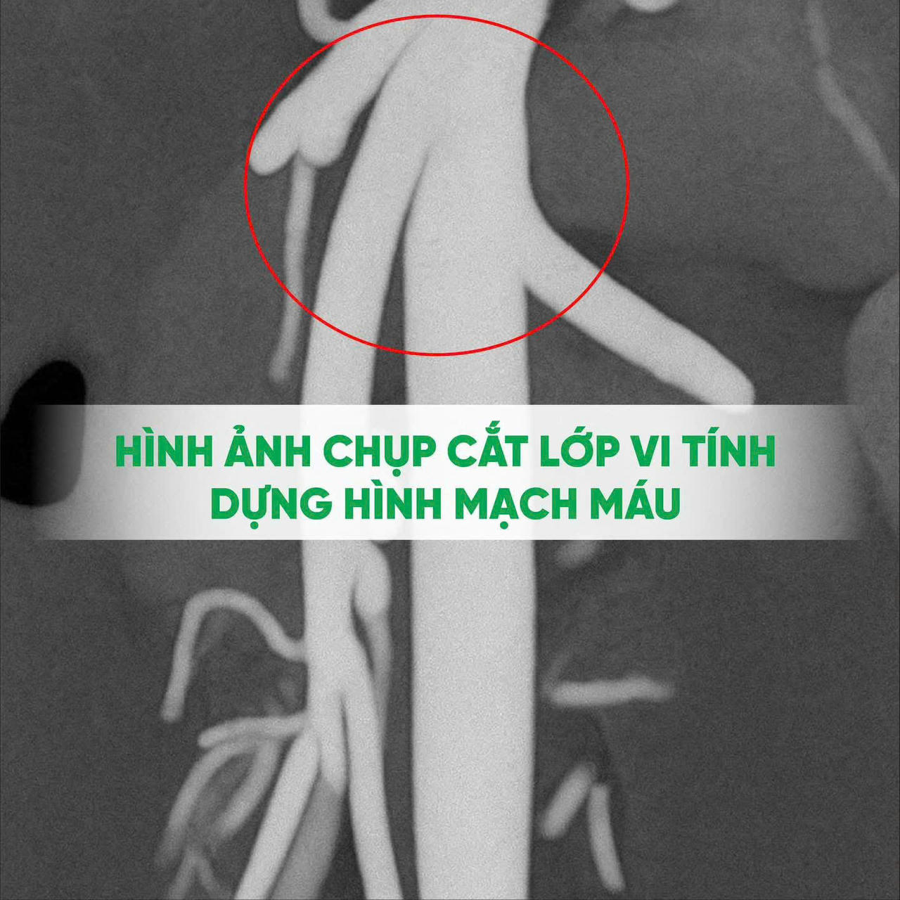 Bệnh viện ĐKTP Vinh: mở ra hy vọng cho chàng trai mắc căn bệnh hiếm gặp