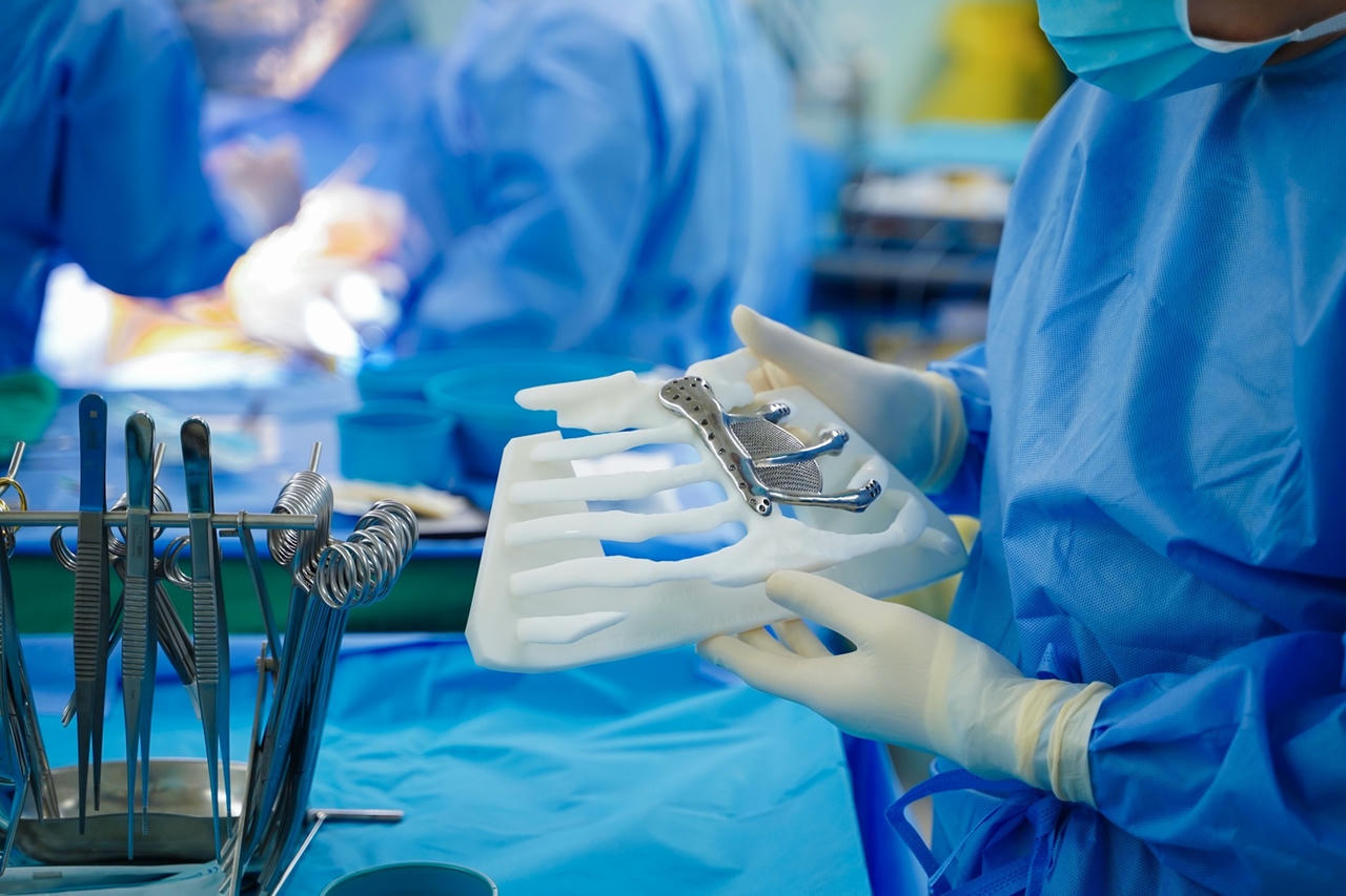 Tái tạo lồng ngực bằng hợp kim titan in 3D với tấm lưới chống thoát vị phổi đạt độ chính xác 99%, đảm bảo chức năng hô hấp và bảo vệ cơ quan nội tạng  