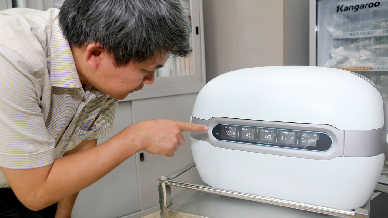 Máy bảo quản thận liên tục có hạ nhiệt được Bệnh viện Trung ương Huế sử dụng trong ca ghép thận cho bệnh nhân Trần Q.