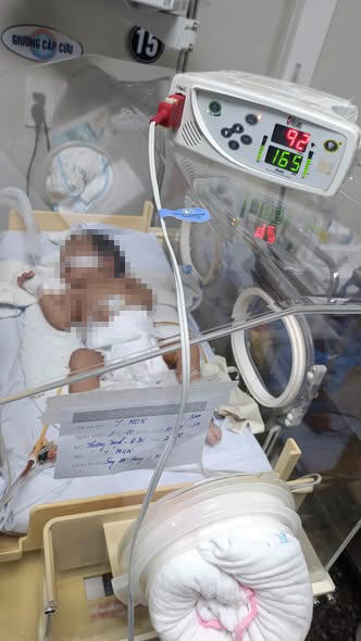 Sau 28 ngày điều trị tích cực, bé Y.M đã hồi phục và xuất viện ngày 27/10. (Ảnh: BVCC)