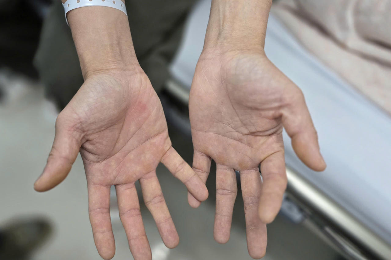 Đôi vợ chồng trẻ Hà Nội liệt người sau chơi ‘bóng cười’