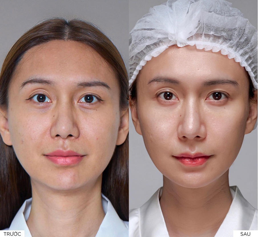 Phác đồ cá nhân hóa cho Lynk Lee: đúng vấn đề, đúng tầng đích