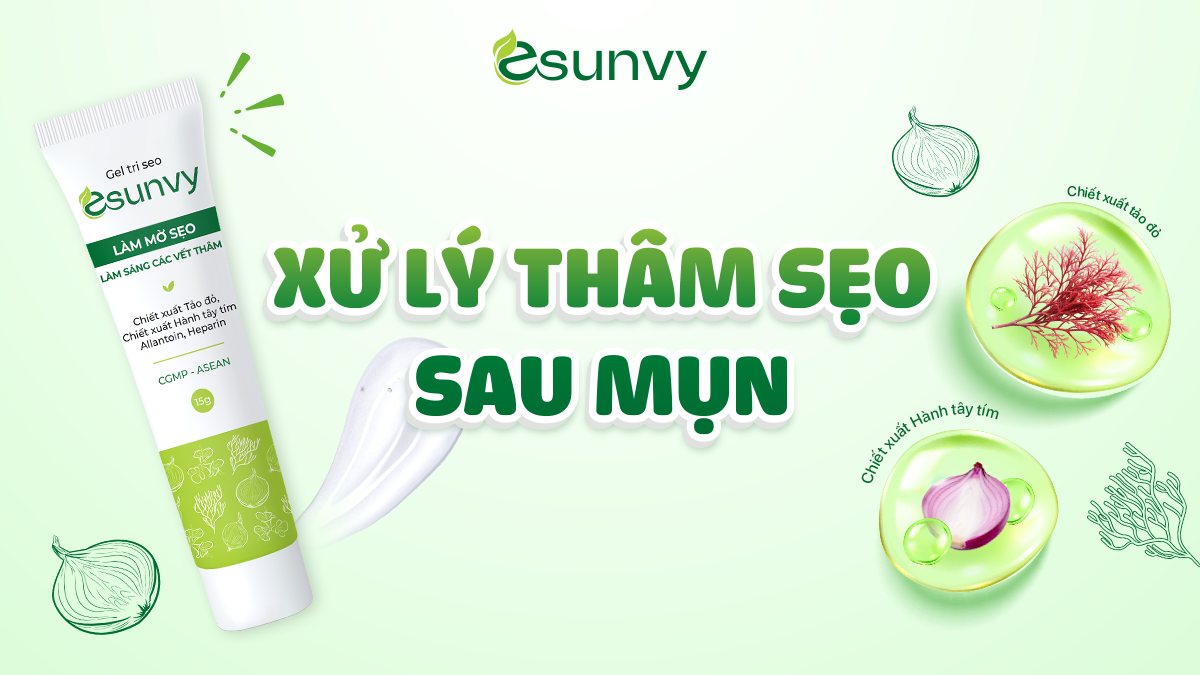 Gel tri seo Esunvy hỗ trợ xử lý thâm sẹo sau mụn
