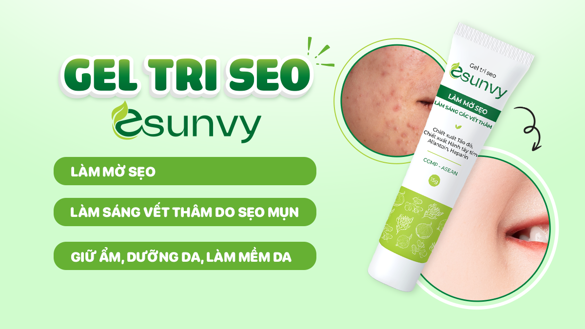 Gel tri seo Esunvy - bạn đồng hành lý tưởng trong chăm sóc thâm sẹo sau mụn