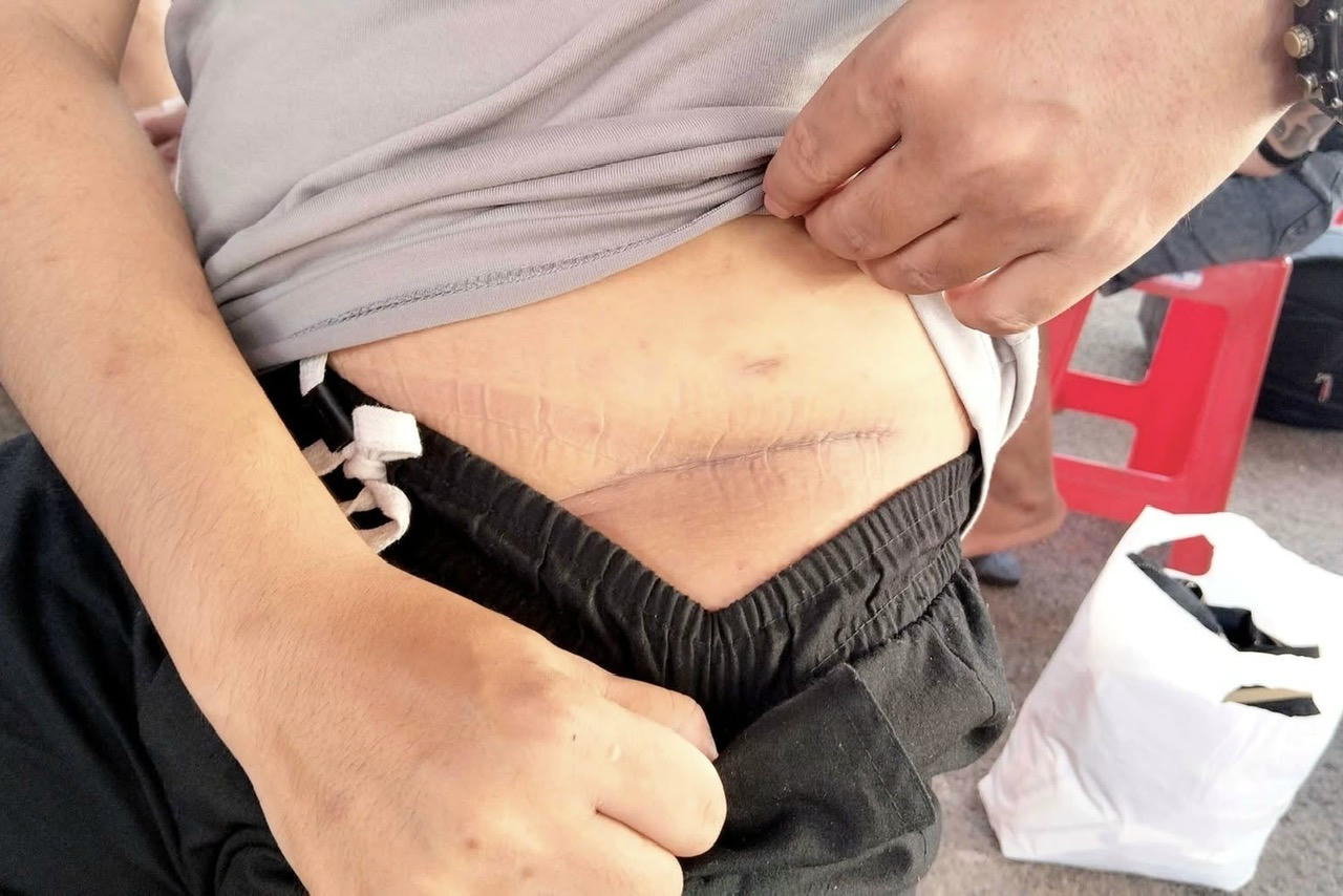 Một người đàn ông cho rằng bị các đối tượng bên kia biên giới “cưỡng ép cắt đi một quả thận”. 
(Ảnh trong bài: T.Dũng)