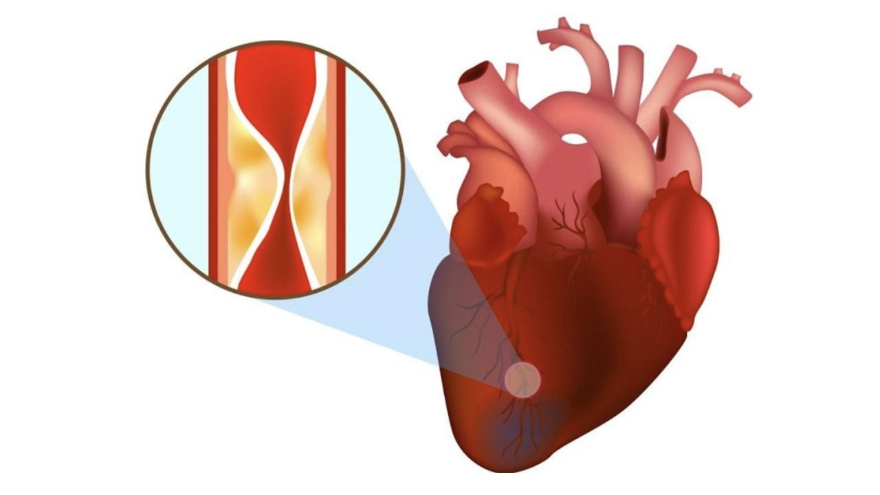 Dòng máu đến tim cần được thông thoáng để bơm máu đều, tránh gây loạn nhịp
