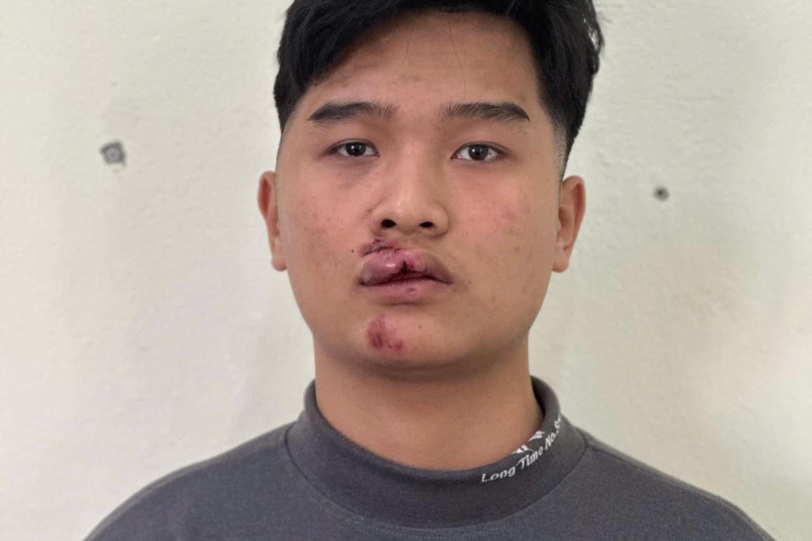 Khởi tố bị can chống người thi hành công vụ tại xã Lương Bằng (Hưng Yên)