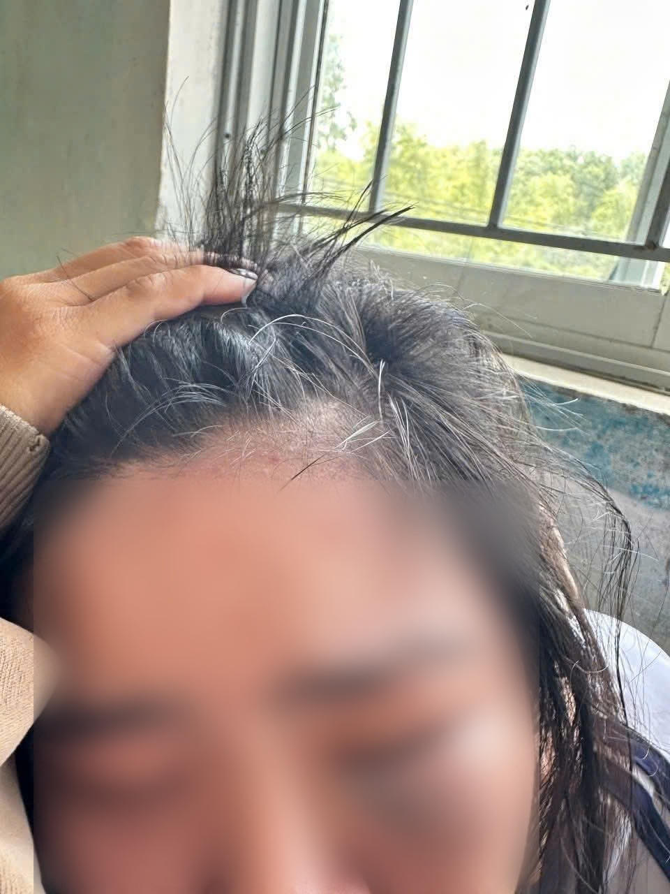 Gia đình đưa cháu D đến Bệnh viện Trung ương Quảng Nam (TP. Đà Nẵng) để kiểm tra, điều trị.