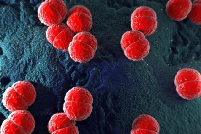 Tăng số ca mắc não mô cầu, Bộ Y tế đề nghị người dân chủ động phòng bệnh