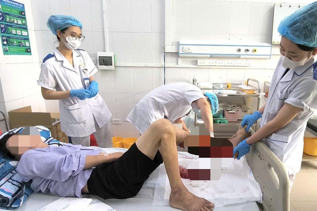 Biến chứng nguy kịch khi xử lý vết thương tại nhà