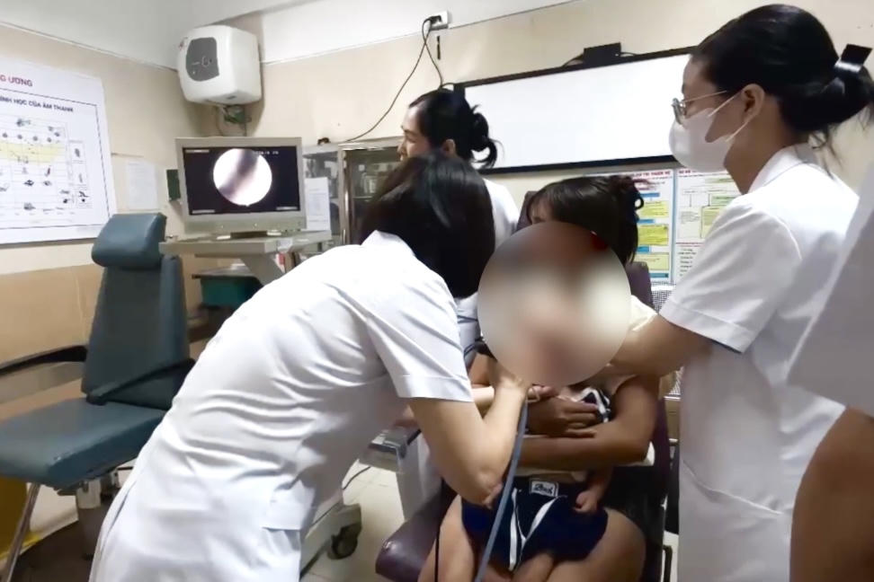 Bé gái 2 tuổi nhập viện do bọ chét ký sinh trong màng nhĩ