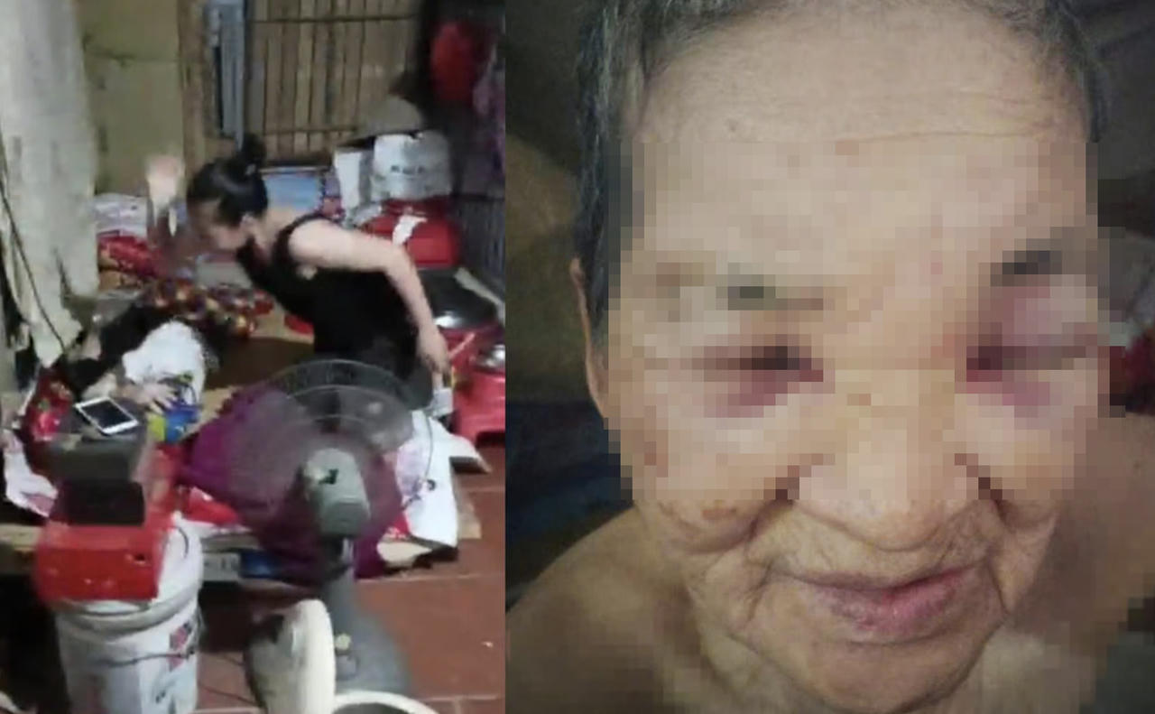 Hình ảnh cụ B. bị "hành hạ" và những vết thương do con gái ruột của cụ gây ra (Ảnh: Gia Hải).