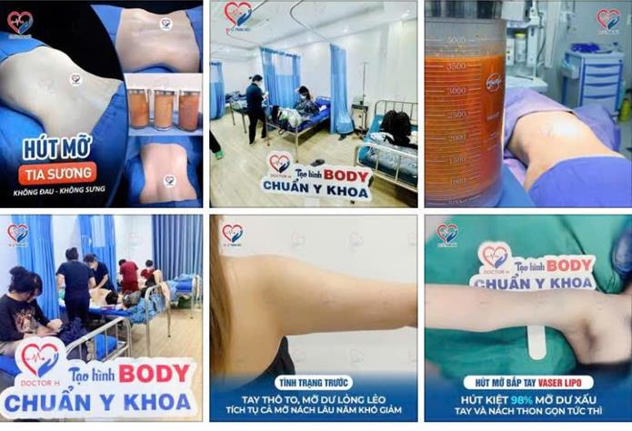Một số nội dung quảng cáo dịch vụ thẩm mỹ của cơ sở Julia Aesthetic được đăng tải trên mạng xã hội.