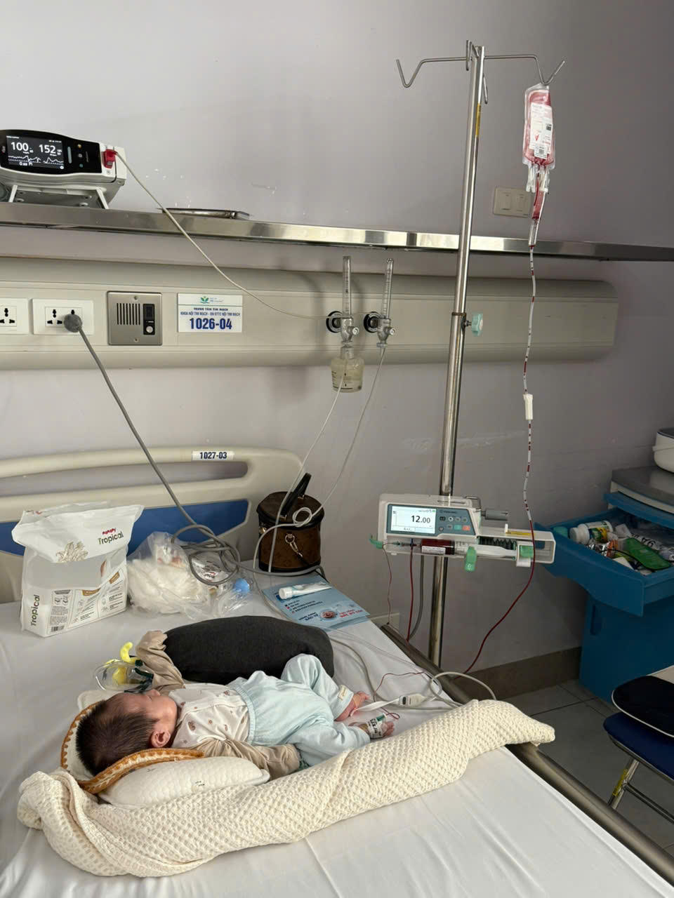 Bé Phúc Thiên vẫn cần phải nằm viện theo dõi liên tục từ 6 tháng đến 1 năm.