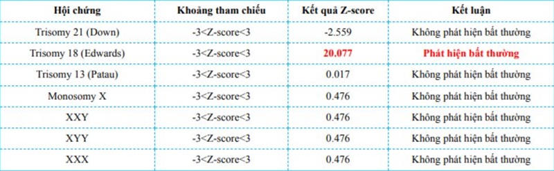 Xét nghiệm NIPT phát hiện bất thường ở nhiễm sắc thể Trisomy 18.