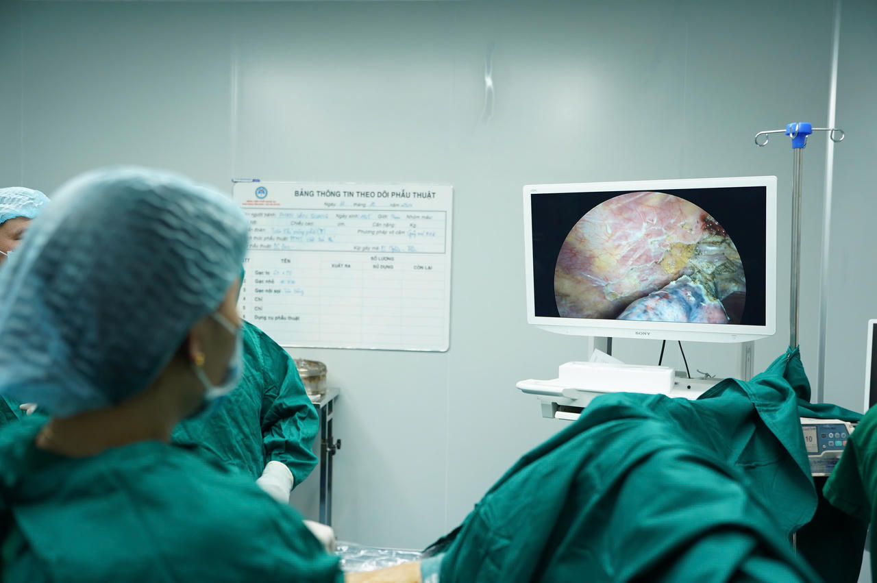 Bệnh viện Phổi Nghệ An từng bước làm chủ kỹ thuật chuyên sâu qua 3 ca phẫu thuật cắt kén khí màng phổi phức tạp