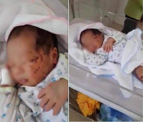 Vụ 'bé trai trong hố nhà vệ sinh': 'Người trong cuộc' nói gì?