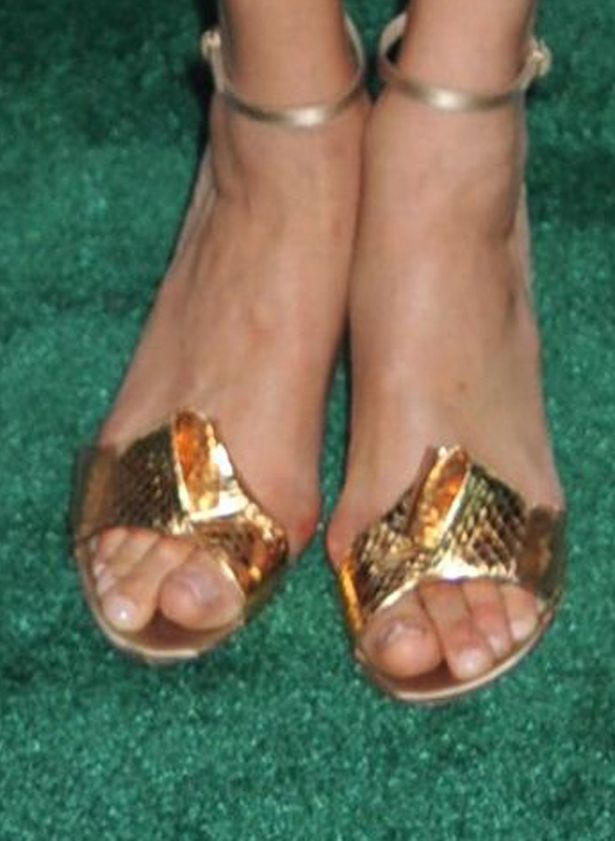 Công nương Meghan Markle để lộ di chứng 'dao kéo' sau chuyến công du cùng chồng