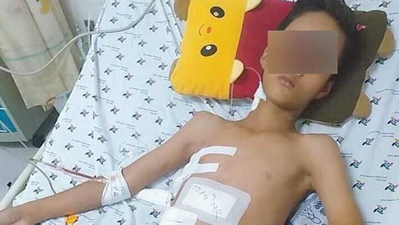 Bé trai nghèo bị thanh sắt đâm xuyên từ bụng lên ngực