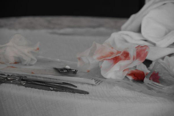 Bố mẹ tự cắt bao quy đầu tại nhà, con trai 5 tháng tử vong