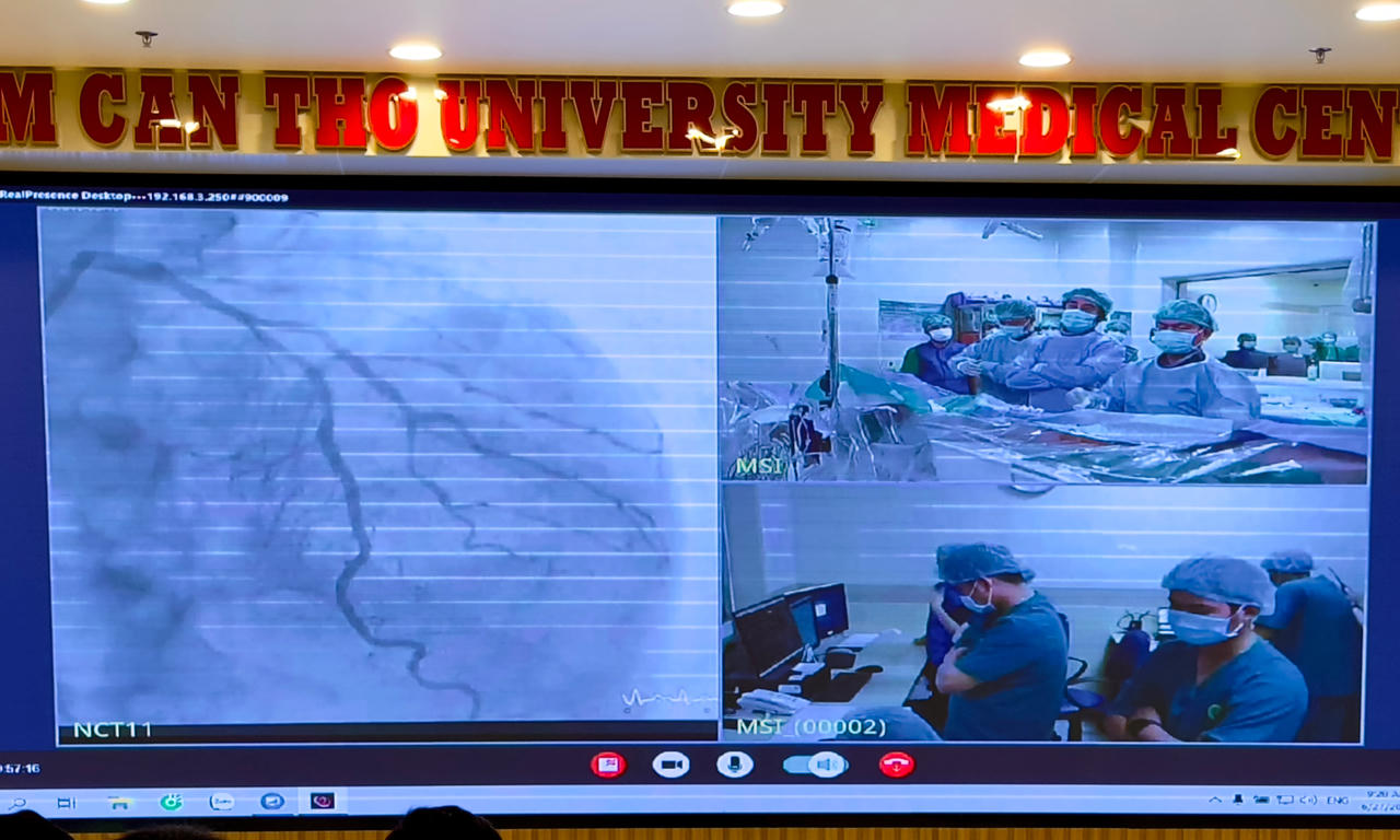 BV Đại học Nam Cần Thơ tiếp nhận kỹ thuật can thiệp tim mạch từ BV Chợ Rẫy