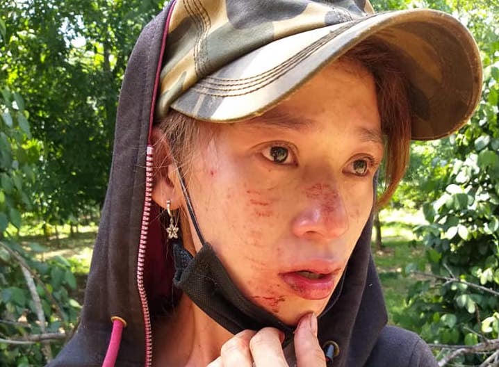 Nghi án cặp vợ chồng bị nhóm người đòi nợ thuê đánh rồi bắt quỳ giữa nắng