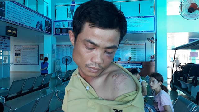 Nghi án cặp vợ chồng bị nhóm người đòi nợ thuê đánh rồi bắt quỳ giữa nắng